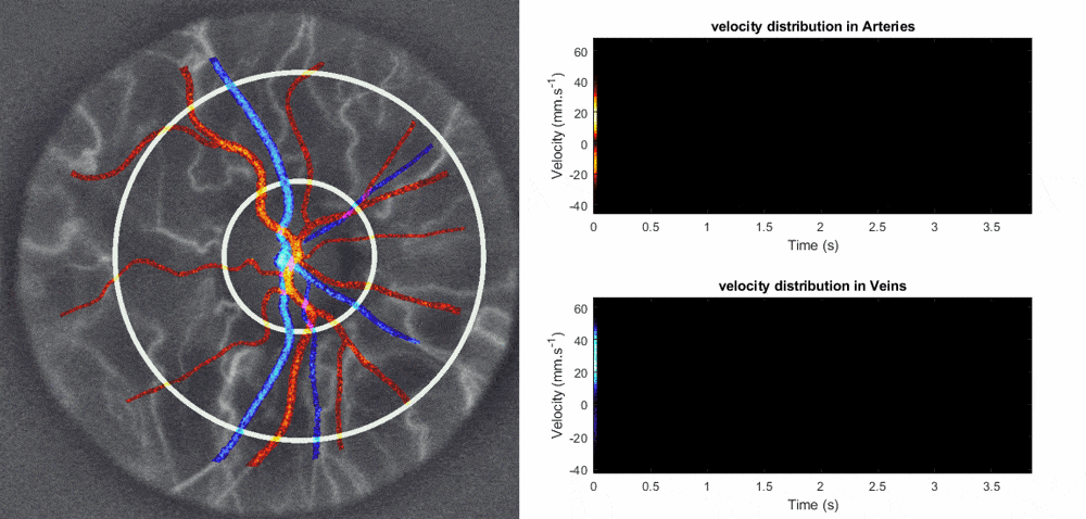 EyeFlow for Doppler hologaphy